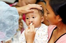 Bec-de-lièvre : opérations gratuites pour des enfants de Binh Dinh