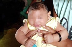 Le Vietnam annonce un premier cas d’enfant atteint d’une microcéphalie