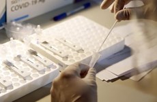Hanoï renforce les tests de dépistage du SARS-CoV-2  