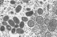 Ho Chi Minh-Ville détecte un deuxième cas de variole du singe