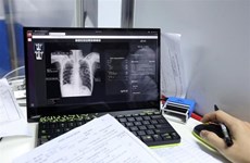 Lancement du jeu interactif « Guerrier contre la tuberculose »
