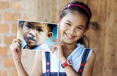 Operation Smile Vietnam rendra le sourire à 200 enfants en mars