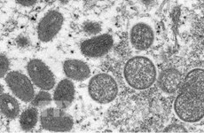 Le Vietnam n’a enregistré aucun cas de variole du singe 