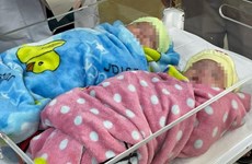 Des jumeaux survivent après une naissance prématurée, ne pesant que 500 g