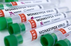 Le Cambodge enregistre trois nouveaux cas de variole du singe