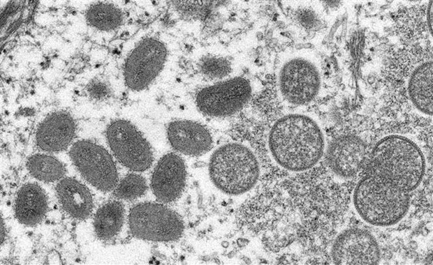 Ho Chi Minh-Ville detecte un deuxieme cas de variole du singe hinh anh 1