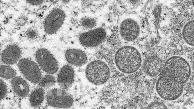 Le Vietnam n’a enregistre aucun cas de variole du singe hinh anh 2