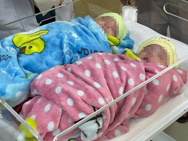 Des jumeaux survivent apres une naissance prematuree, ne pesant que 500 g hinh anh 1